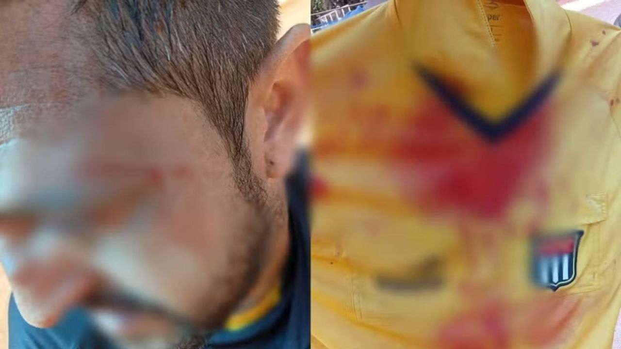 árbitro lesionado após agressão em campo