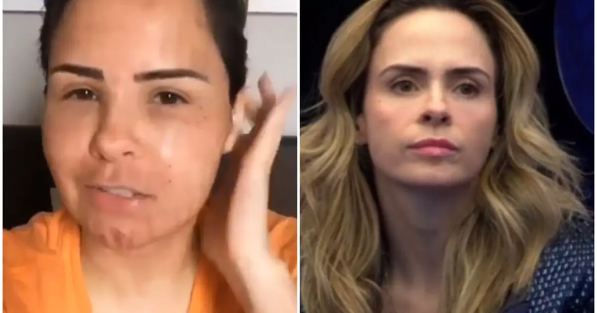 Ana Paula Renault em vídeo de 2019 antes de procedimento estético