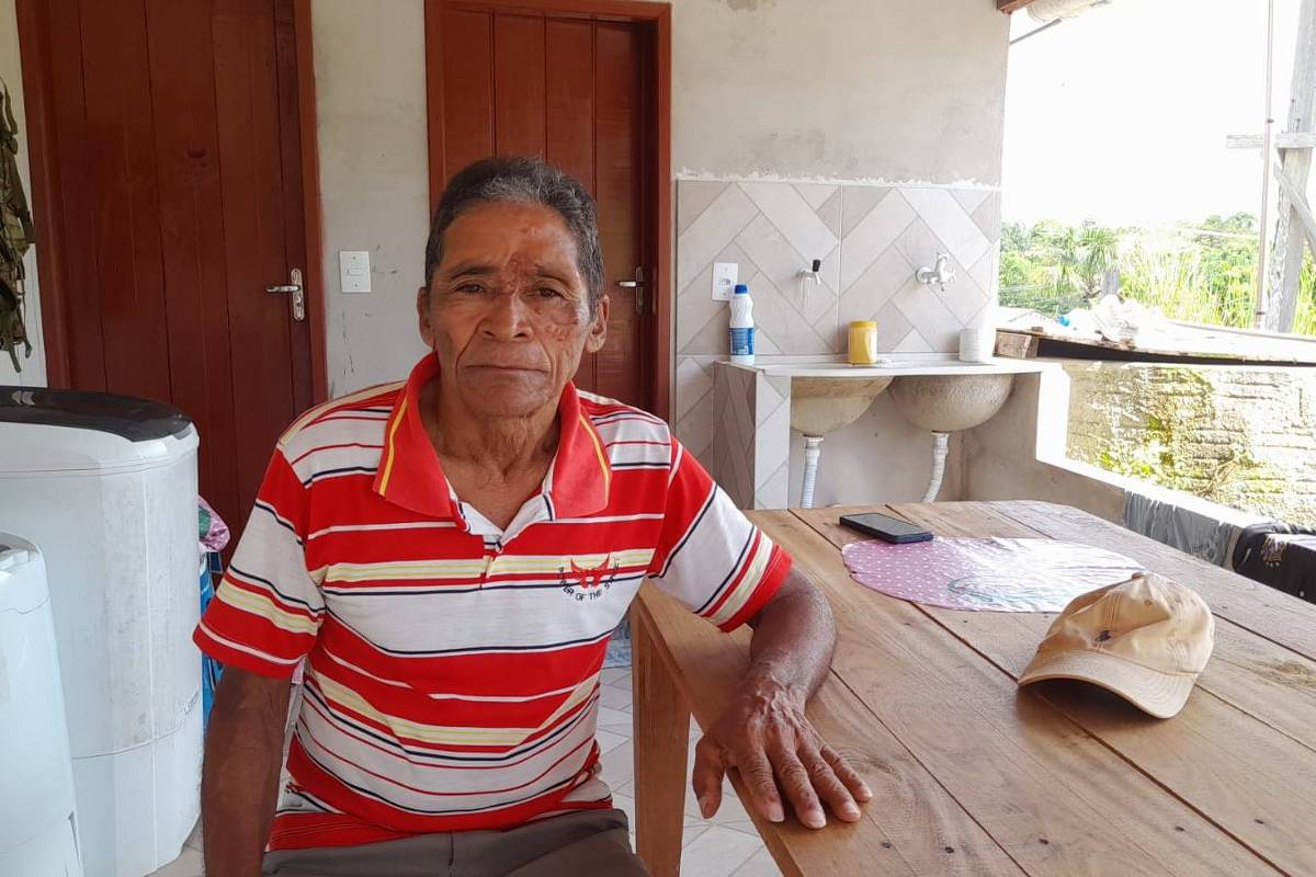 Paciente com lesões causadas pela Doença de Jorge Lobo