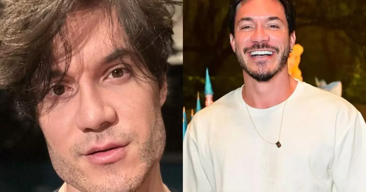 Ex-participantes do BBB após procedimentos estéticos