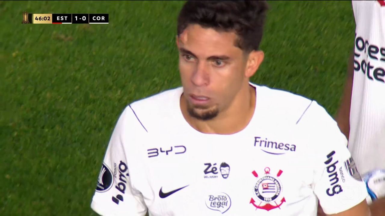 Gabriel Paulista com inchaço na testa após choque