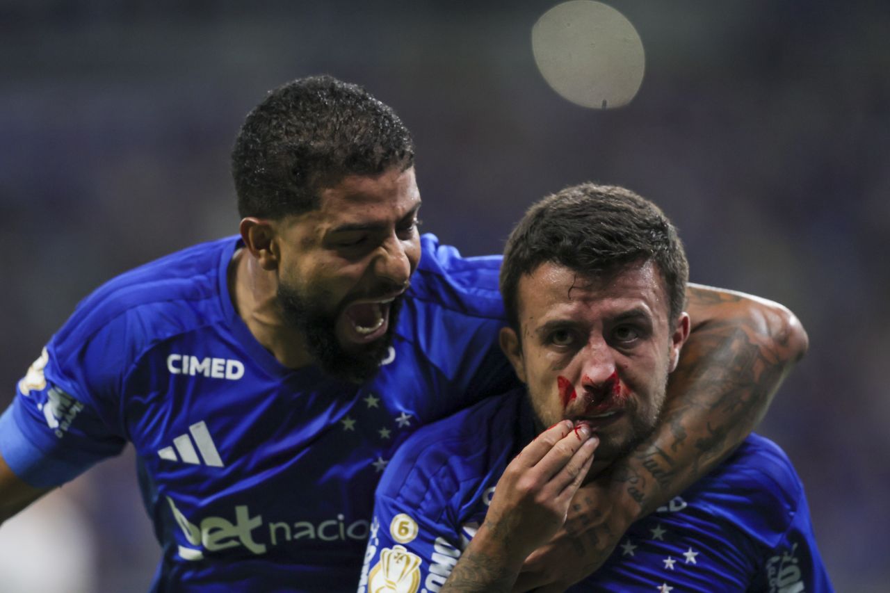Matheus Henrique com gelo no nariz após o gol