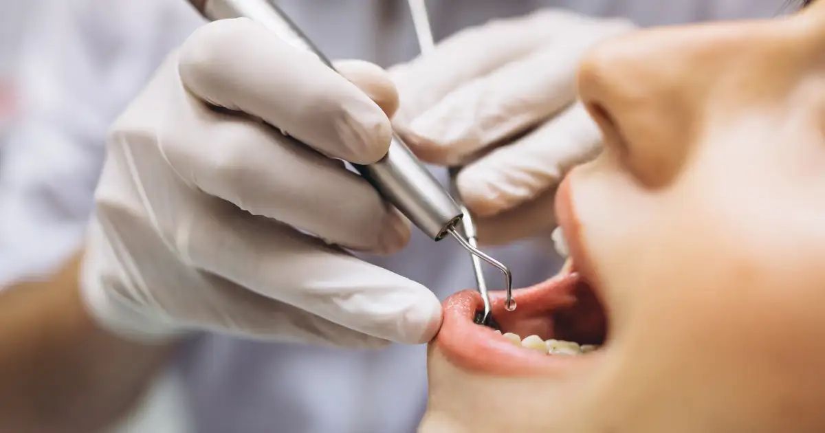 Radiografia panorâmica dental exibida em tela de computador